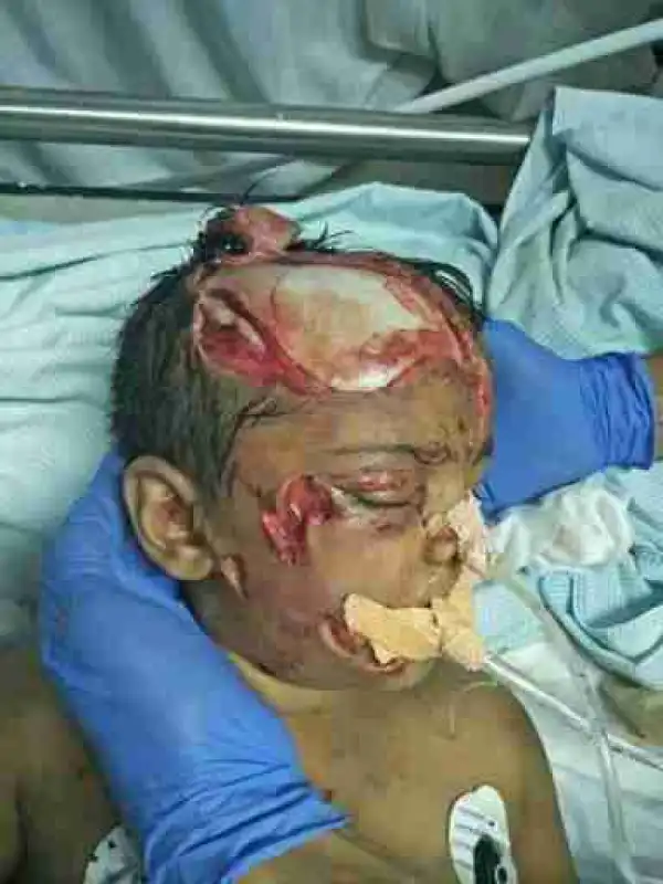 Viewers Discretion Is Totally Advised – See Photo Of A Baby Fighting For Its Life Due To Dog Bite